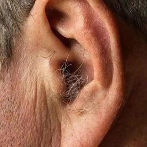 Did you know that if hair grows on your ears, it’s because …. Read