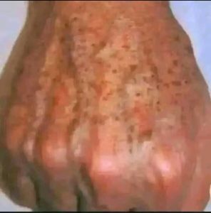 if you get STAINS on your HANDS it’s because you have… See more