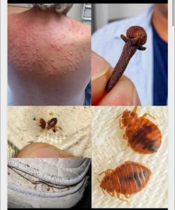 If you spot these dots on your skin, it means you have Ca…see more