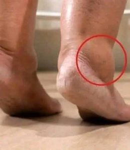 These are signs that he is a cr… See